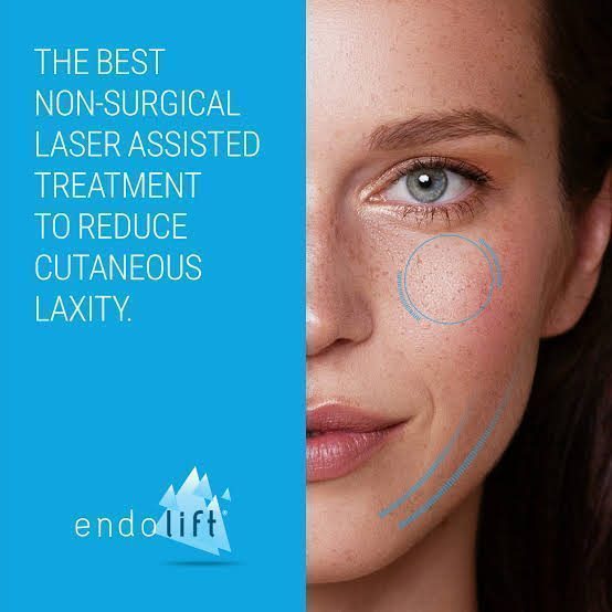 Ендоліфтинг Endolift — революція в безопераційній підтяжці
