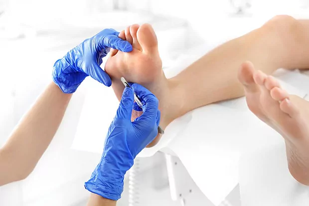 Diagnoza i terapia zmian skórnych na stopach/paznokciach