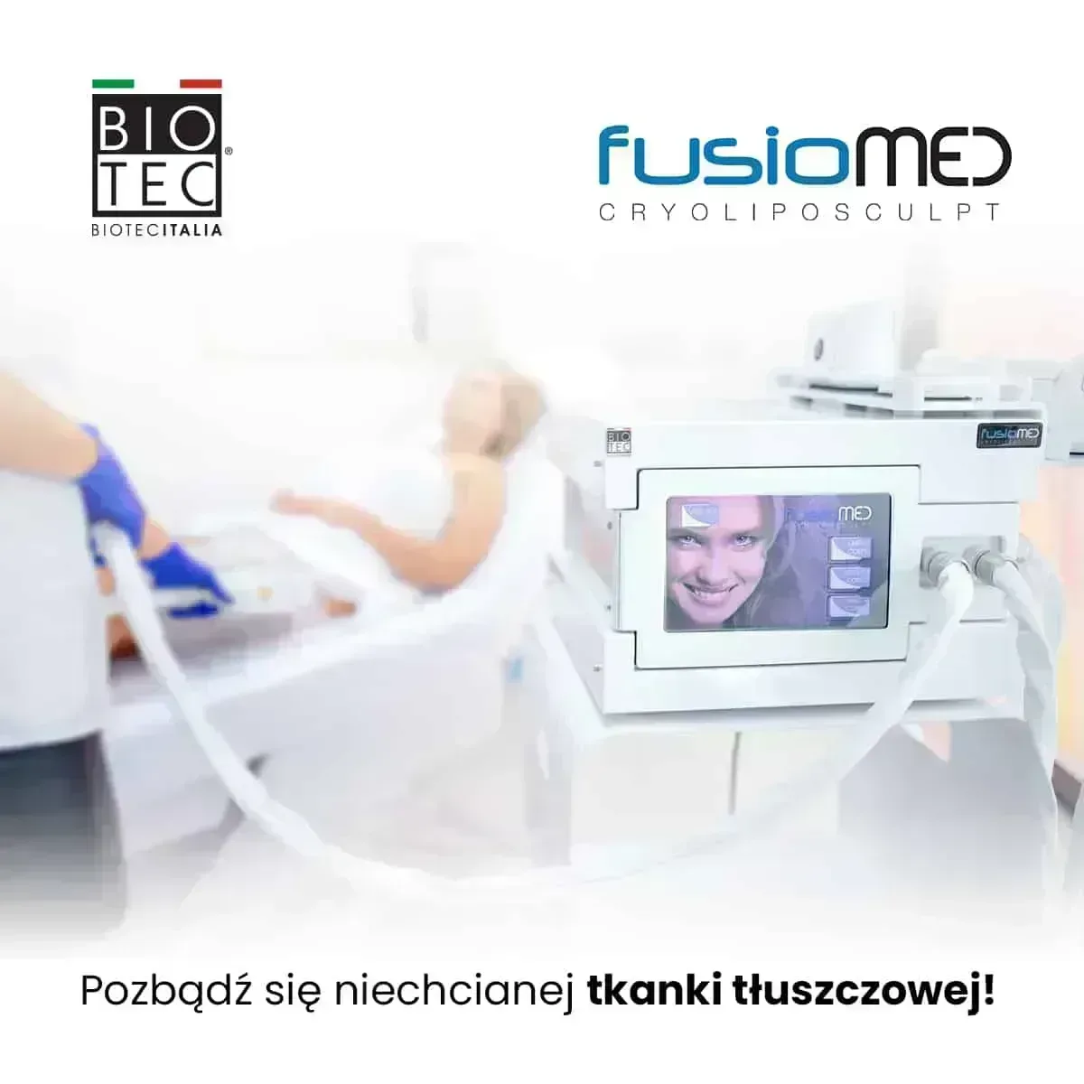 Cryoliposculpt