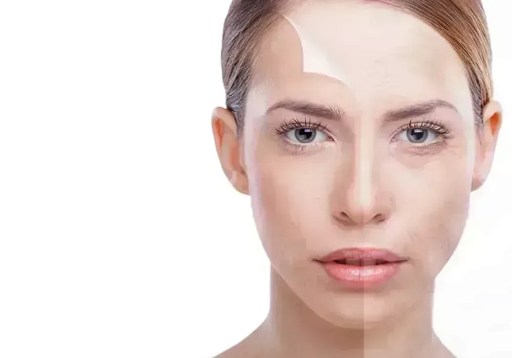 Baby Botox