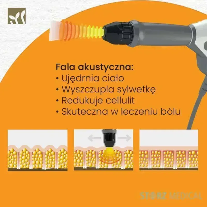 Fala uderzeniowa Storz Medical Gdańsk - Zabieg Medycyny Estetycznej dr Marcin Nowak