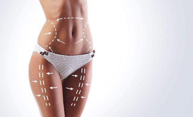 Modelowanie ciała Exilis Elite Gdańsk - Zabieg Medycyny Estetycznej dr Marcin Nowak