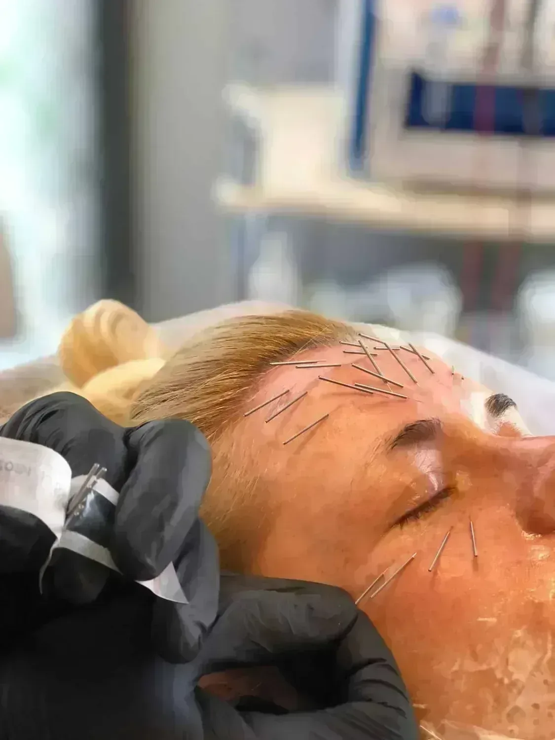 Needle shaping